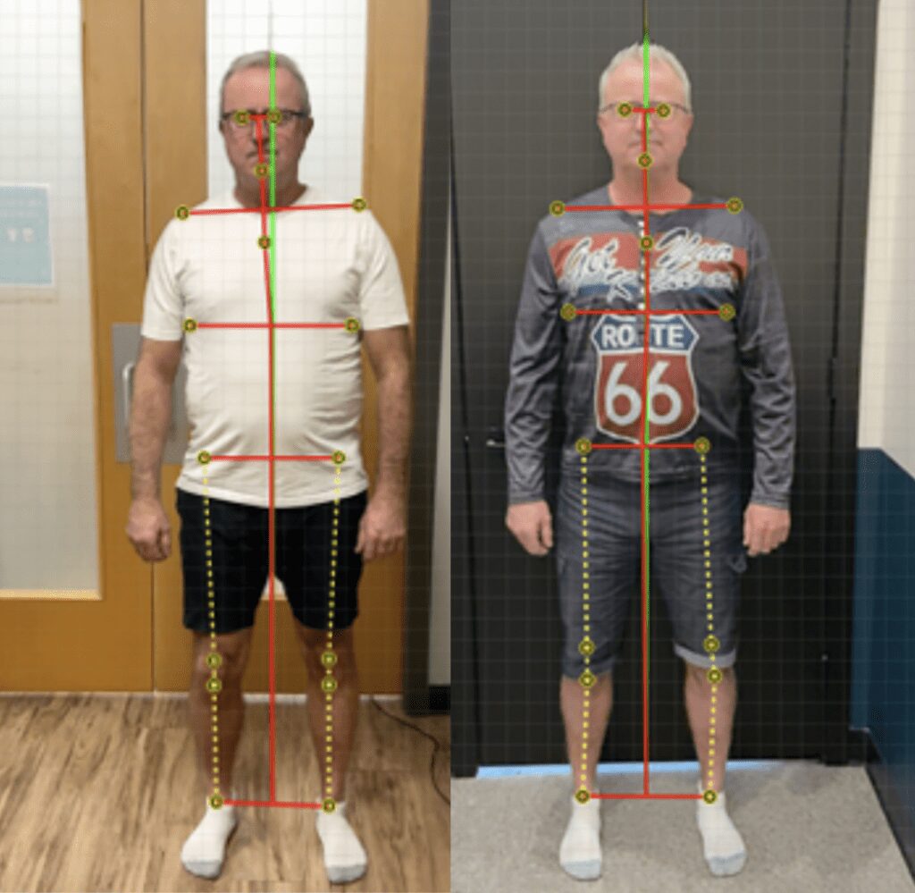 Posture screen analysis from 100+ Health score booklet